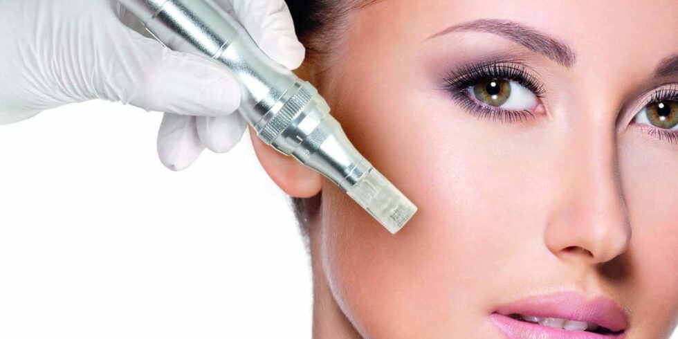 Soin Microneedling Institut Roséa